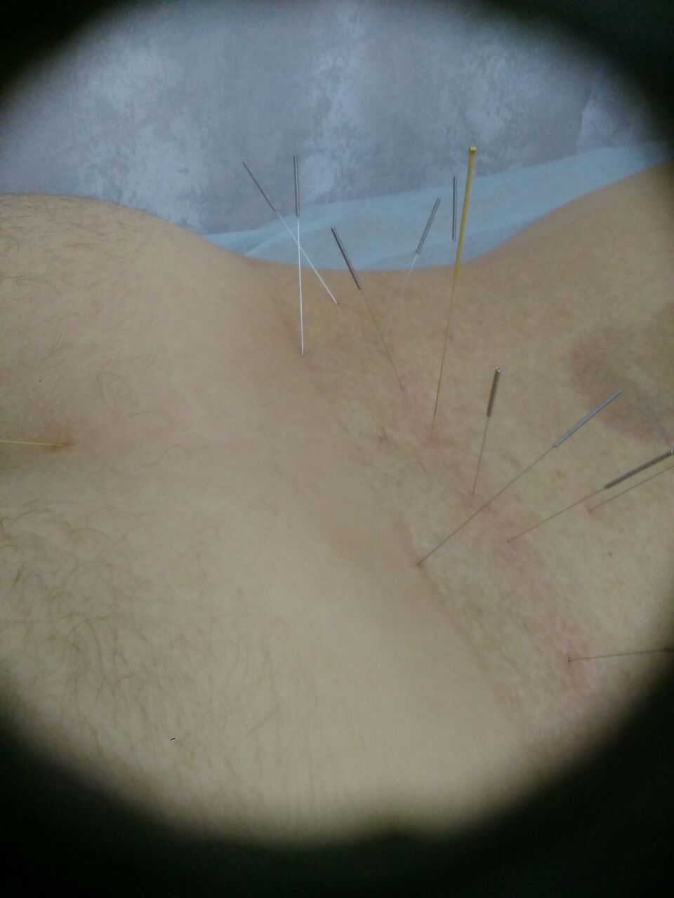 Сильвер Парагогенгейм