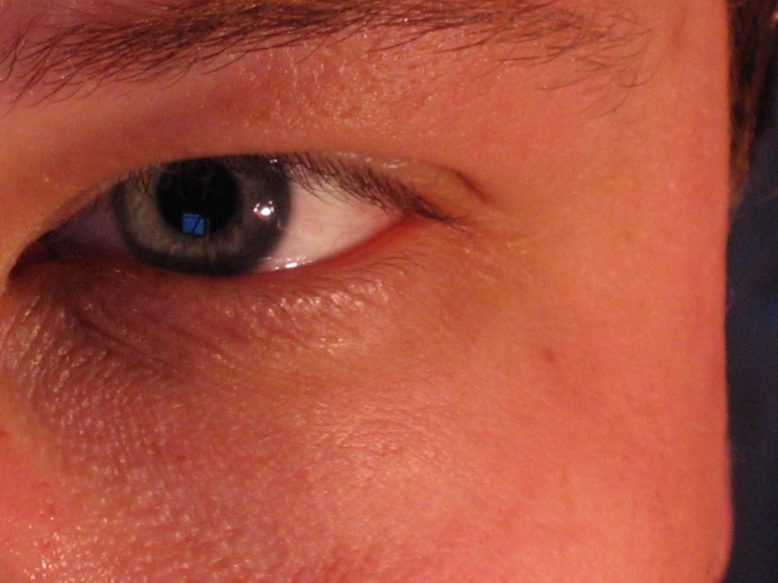 Магазинчик Мистера Блистера