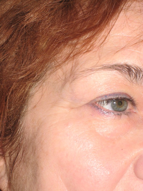 ������� ���