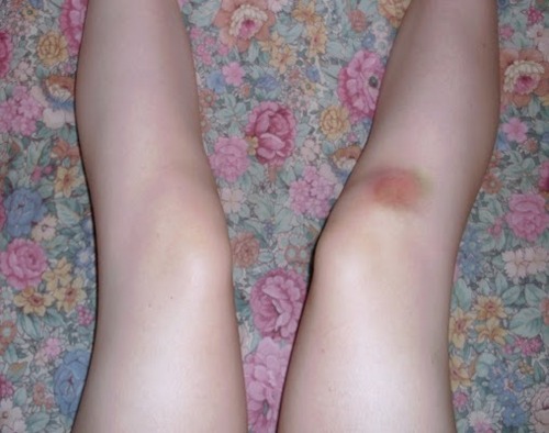 ���� �������