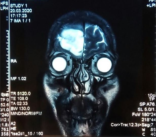 ������ �����