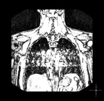 ���� �����������